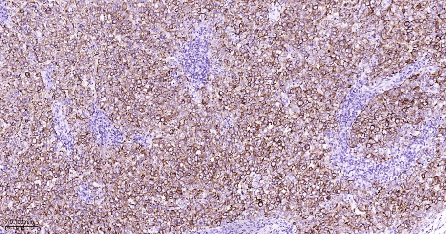 14 - Keratin 7 Recombinant Rabbit mAb AP94677
