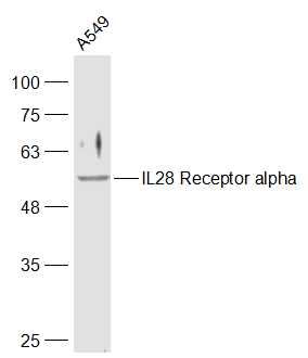 1 - IL28 Receptor alpha Rabbit pAb AP94679
