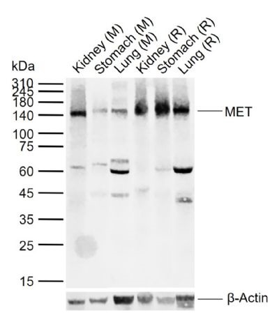 1 - MET Rabbit pAb AP94680