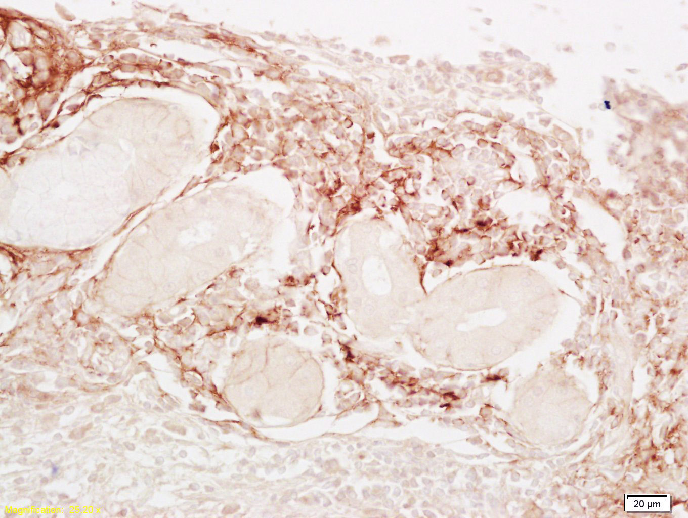 14 - LDL Rabbit pAb AP94684