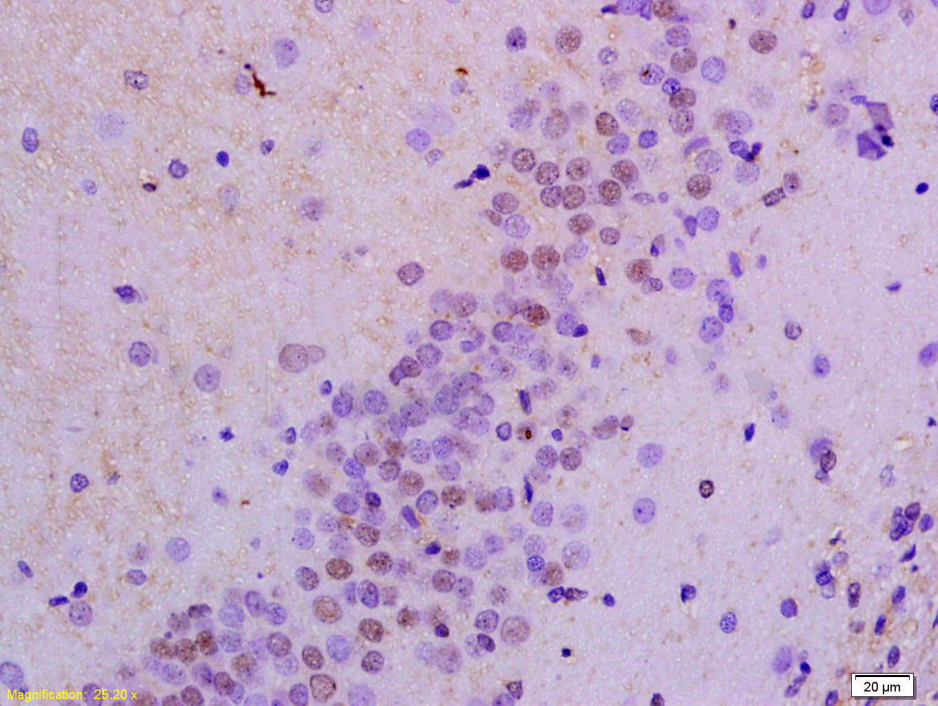 14 - AMPK alpha 1 Rabbit pAb AP94685