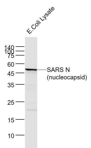 1 - SARS-CoV Nucleocapsid Mouse mAb AP94687