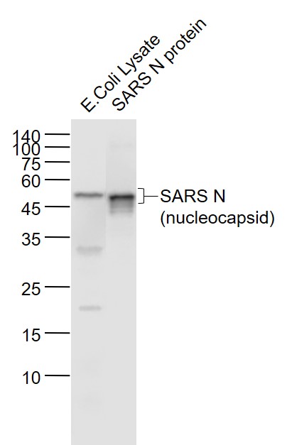 1 - SARS-CoV Nucleocapsid Mouse mAb AP94688
