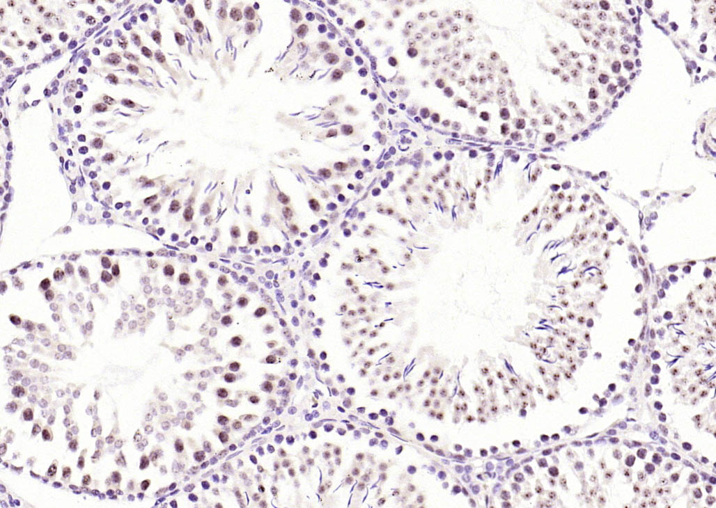 14 - phospho-RPS6KA1 (Ser380) Recombinant Rabbit mAb AP94692