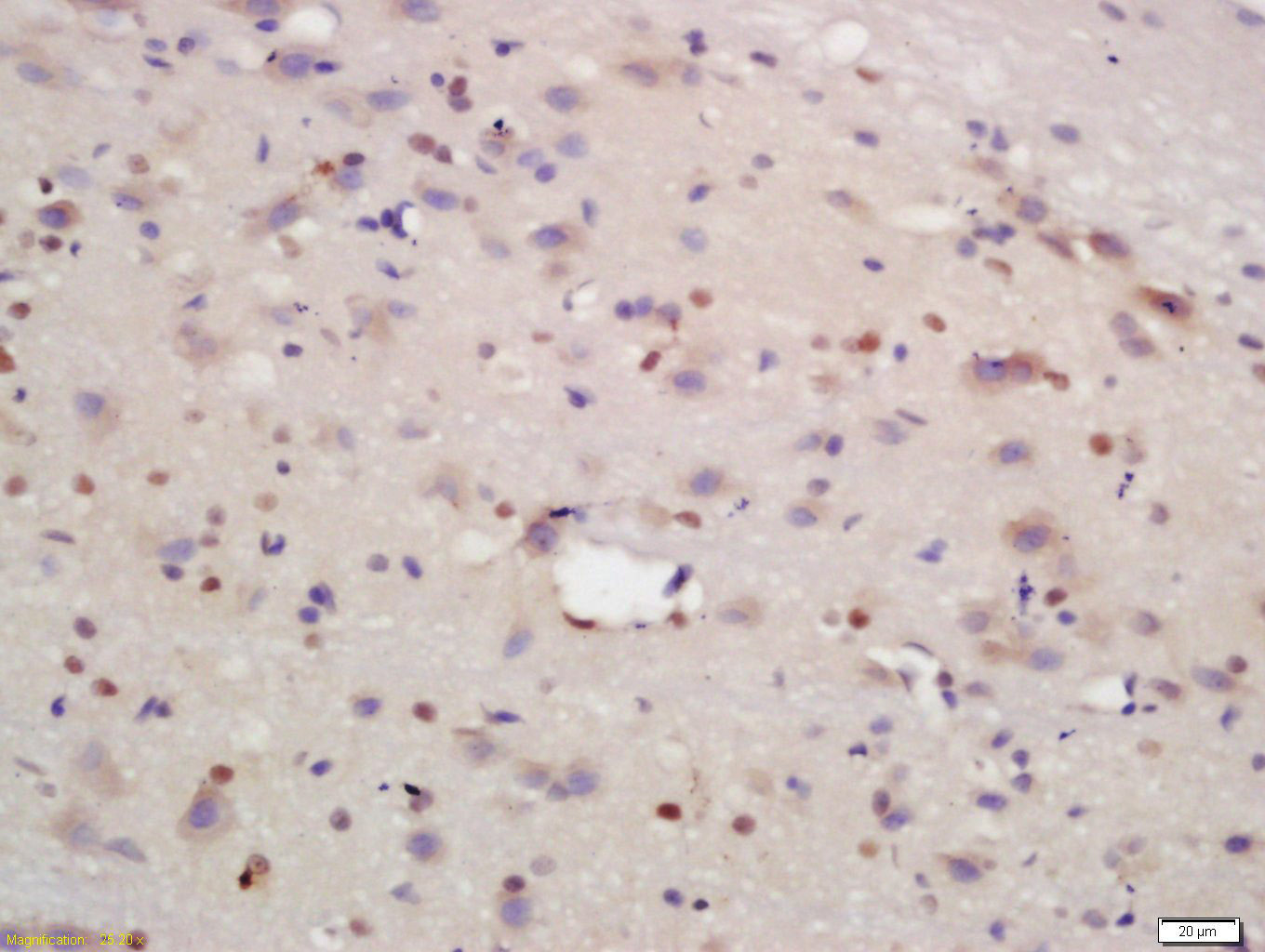 14 - SPAG17 Rabbit pAb AP94693