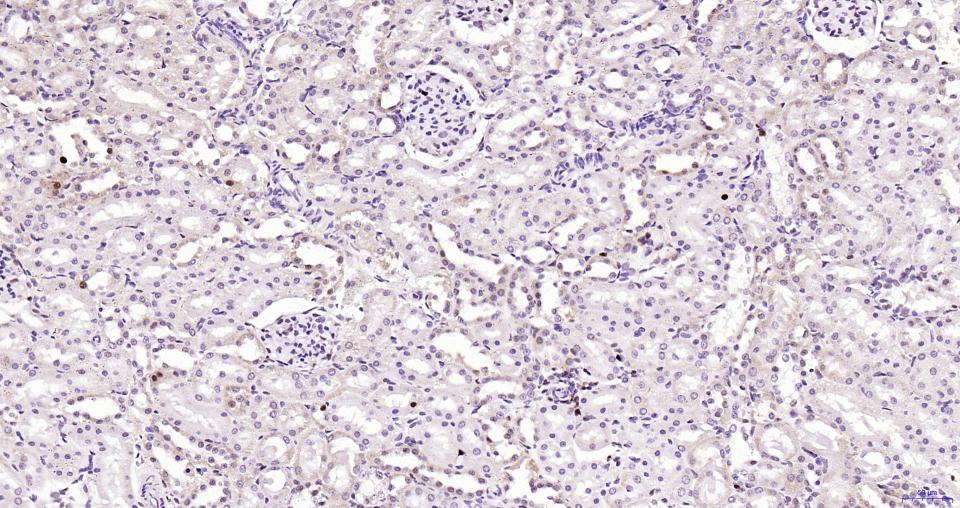 14 - PCNA Recombinant Rabbit mAb, Nuclear Loading Control AP94695