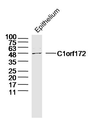 1 - C1orf172 Rabbit pAb AP94698