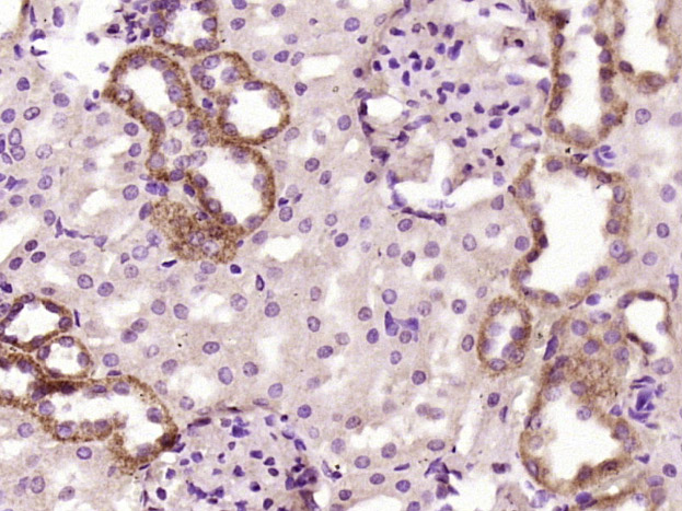 14 - C1orf172 Rabbit pAb AP94698
