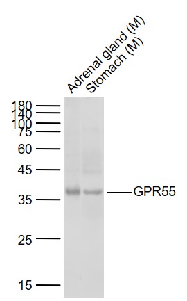 1 - GPR55 Rabbit pAb AP94704
