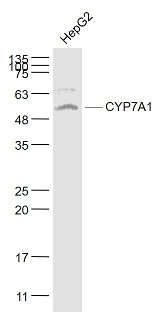 1 - CYP7A1 Rabbit pAb AP94705