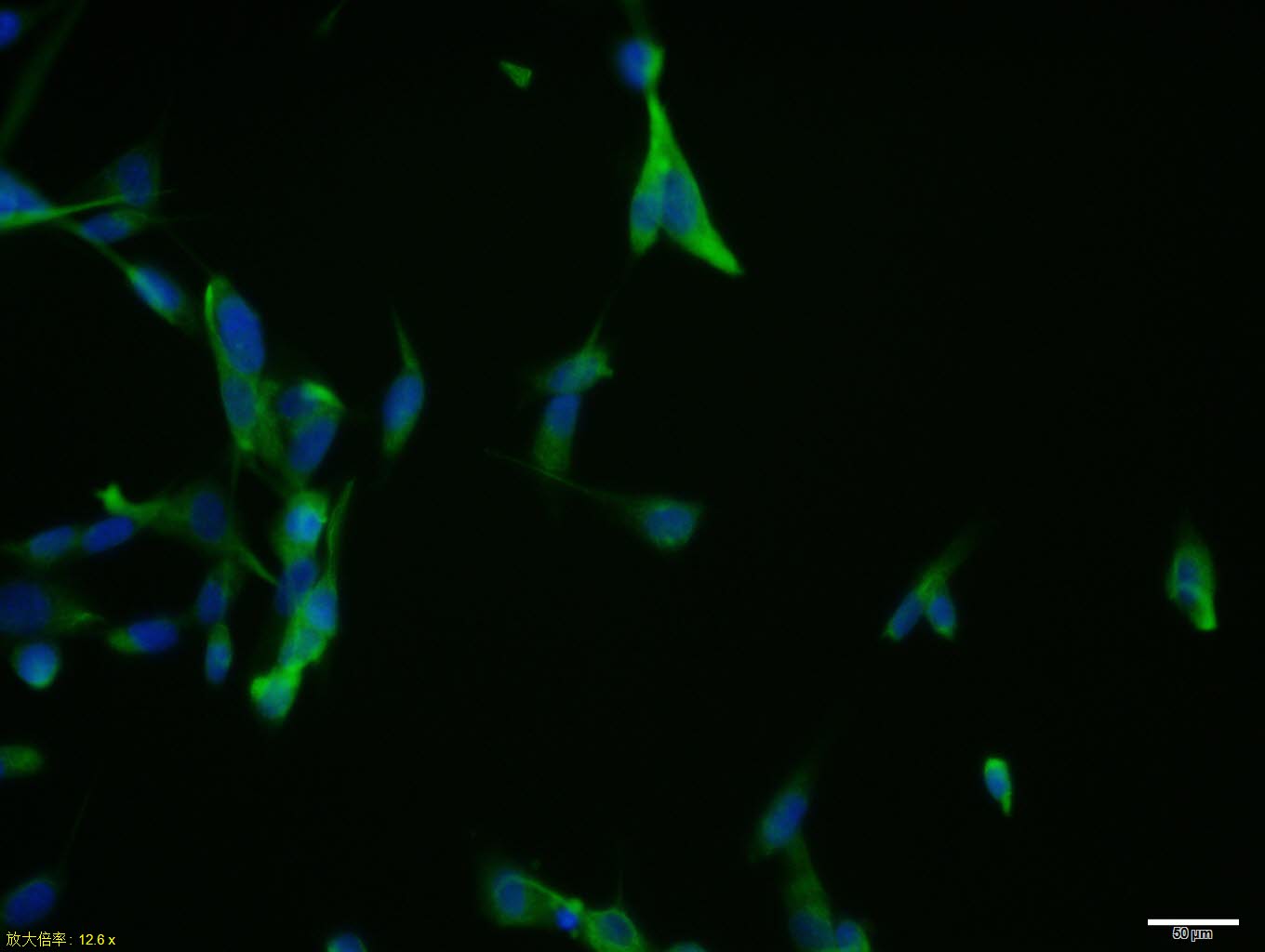0 - CHI3L1 Rabbit pAb AP94706
