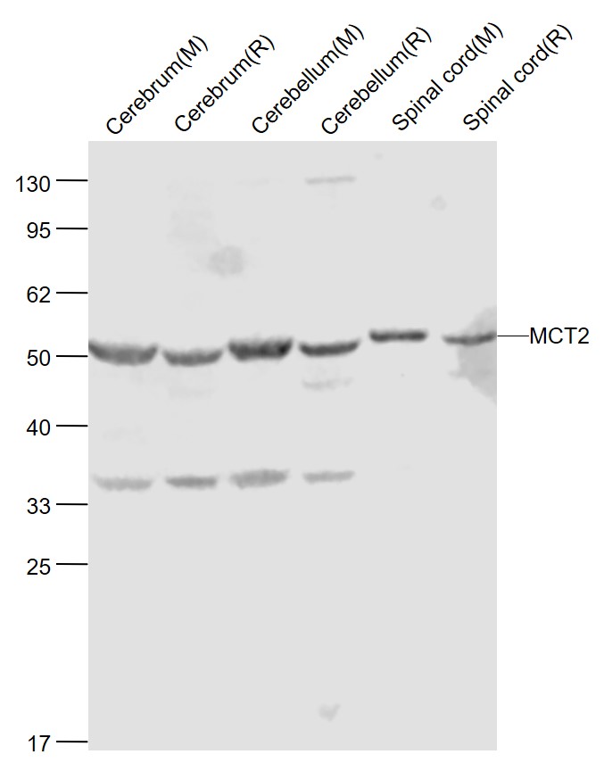1 - MCT2 Rabbit pAb AP94707