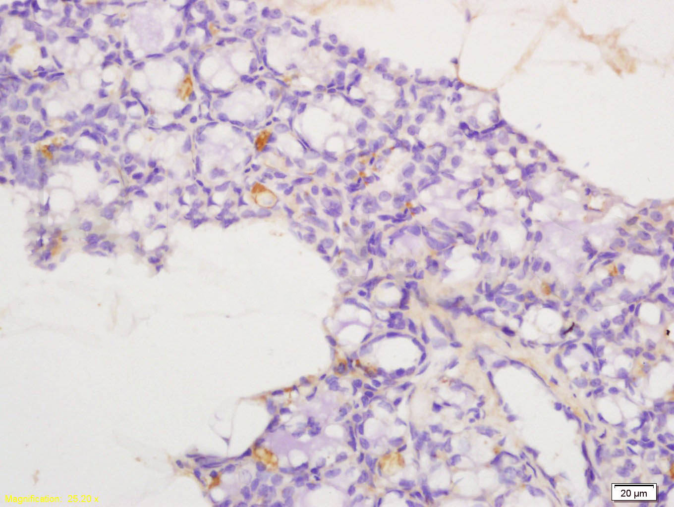 14 - CCL4 Rabbit pAb AP94709