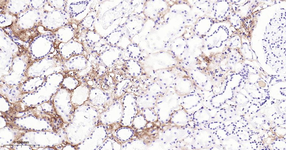 14 - Collagen I Recombinant Rabbit mAb AP94712