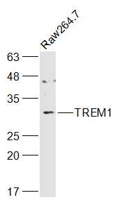 1 - TREM1 Rabbit pAb AP94715