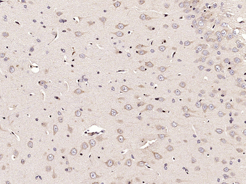 14 - ECE2 Rabbit pAb AP94716