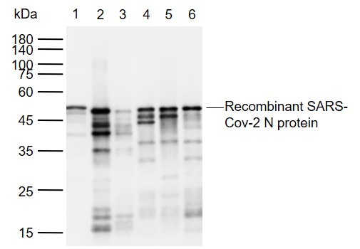 1 - SARS-CoV-2 (2019-nCoV) Nucleocapsid Mouse mAb AP94718
