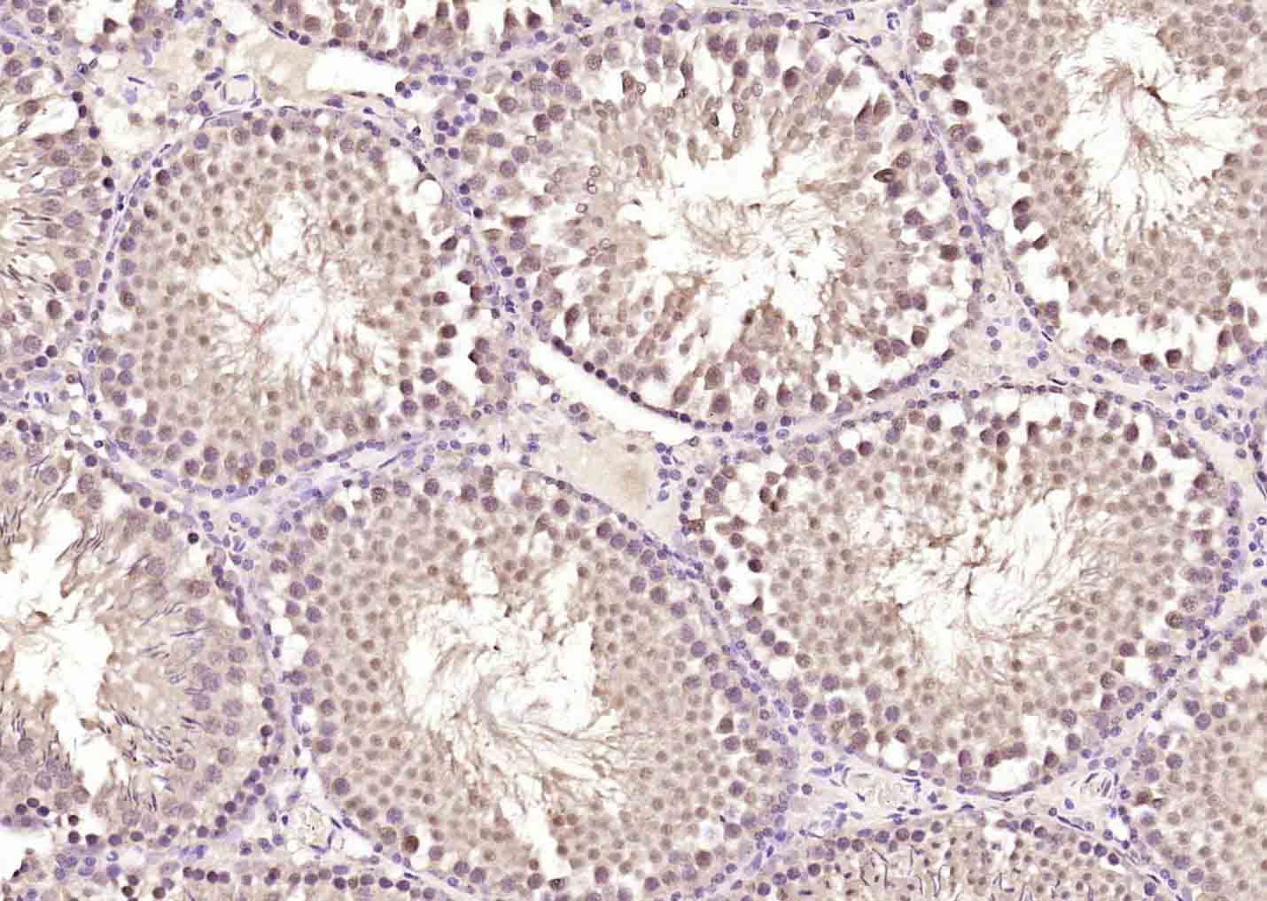 14 - ZNF354C Rabbit pAb AP94719