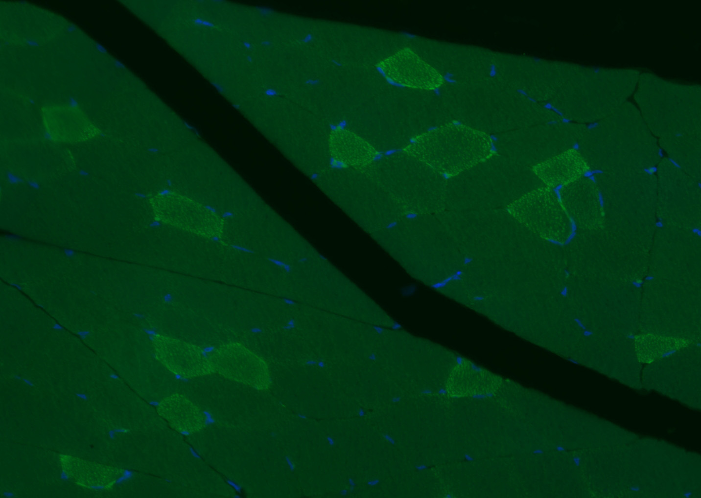 3 - MYH7 Rabbit pAb AP94723