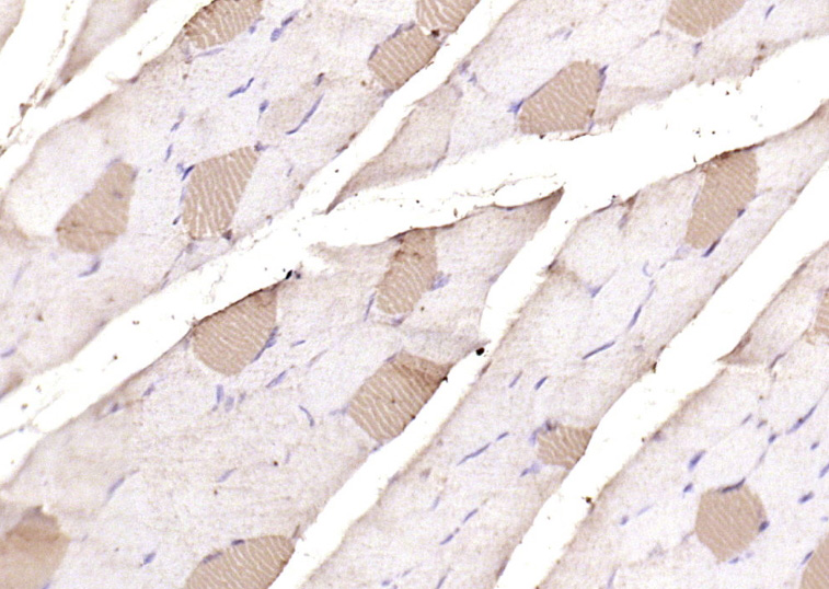 14 - MYH7 Rabbit pAb AP94723
