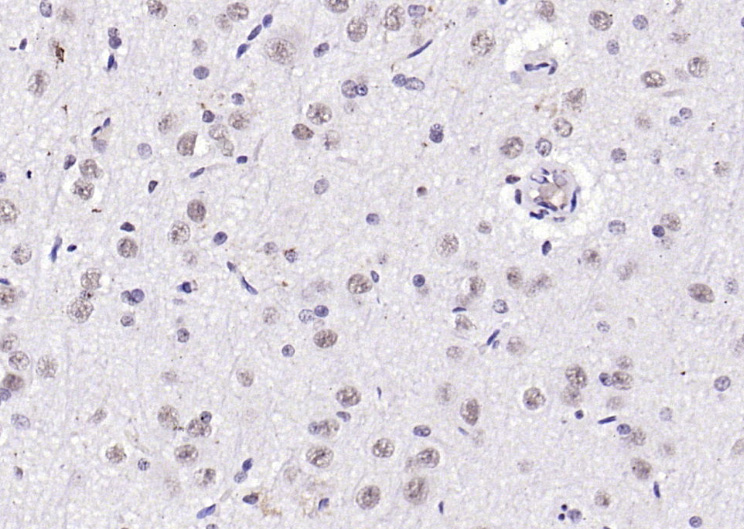 14 - Notch3 Rabbit pAb AP94725