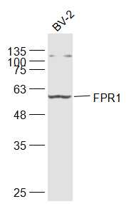 1 - FPR1 Rabbit pAb AP94726