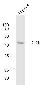 1 - CD4 Rabbit pAb AP94730