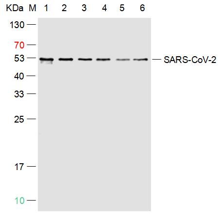 1 - SARS-CoV-2 (2019-nCoV) Nucleocapsid,  WT & Ormicron Recognized Mouse mAb AP94732