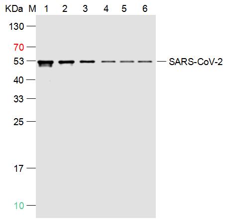 1 - SARS-CoV-2 (2019-nCoV) Nucleocapsid, WT & Ormicron Recognized Recombinant Rabbit mAb AP94733
