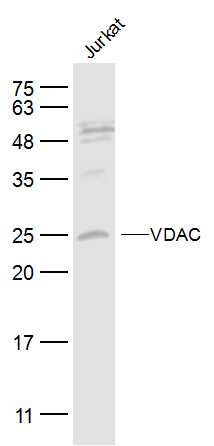 1 - VDAC Rabbit pAb AP94734
