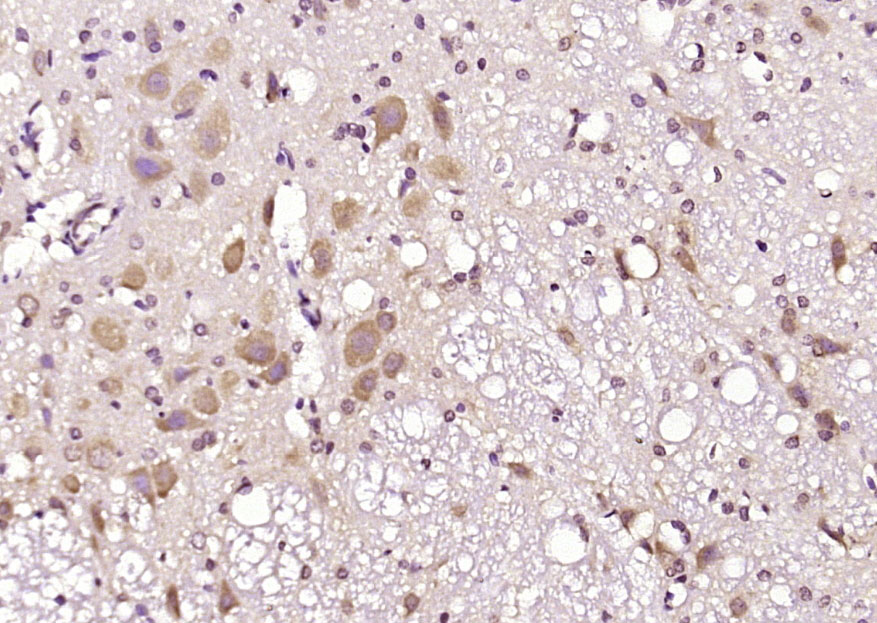 14 - ATG18 Rabbit pAb AP94737