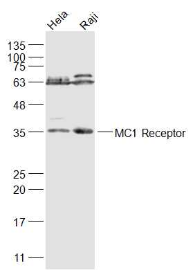 1 - MC1R Rabbit pAb AP94739