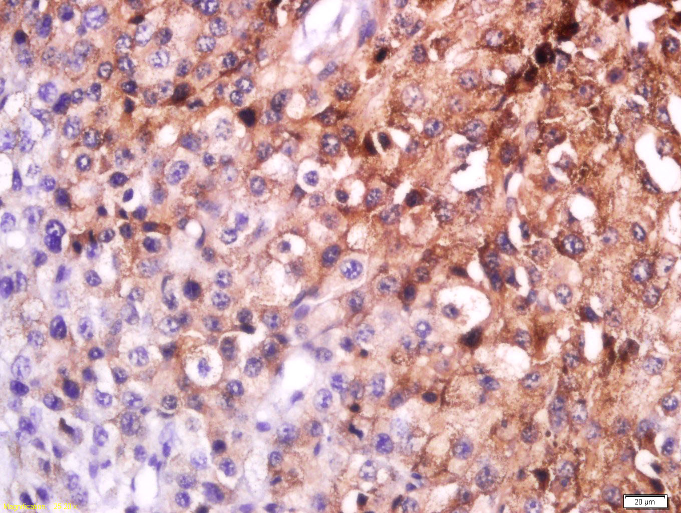 14 - MC1R Rabbit pAb AP94739