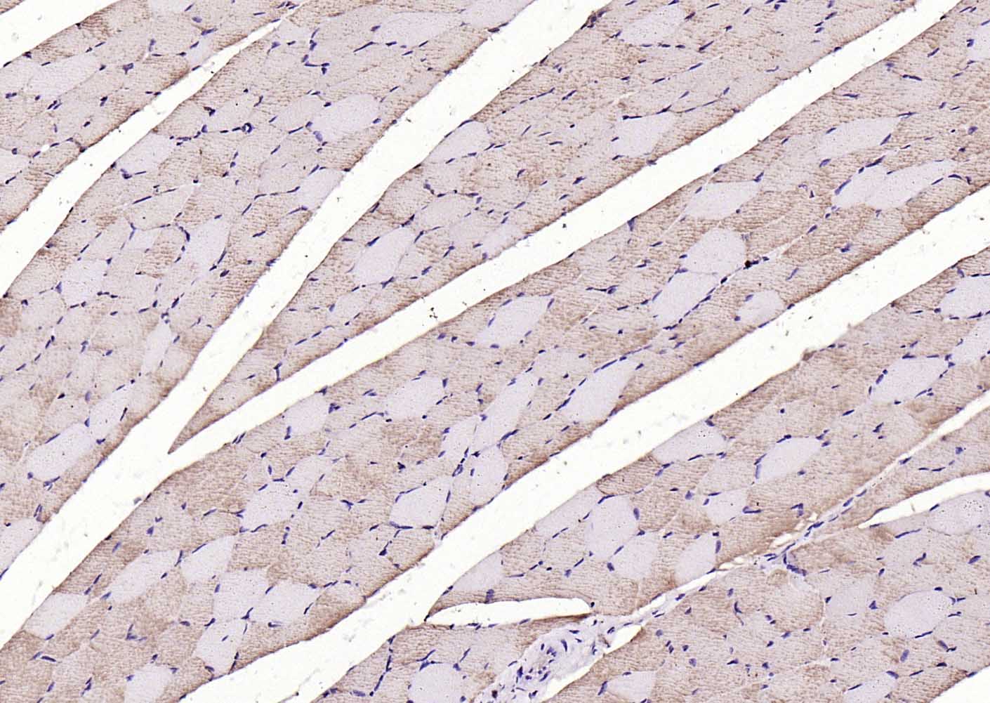 14 - LIFR Rabbit pAb AP94740