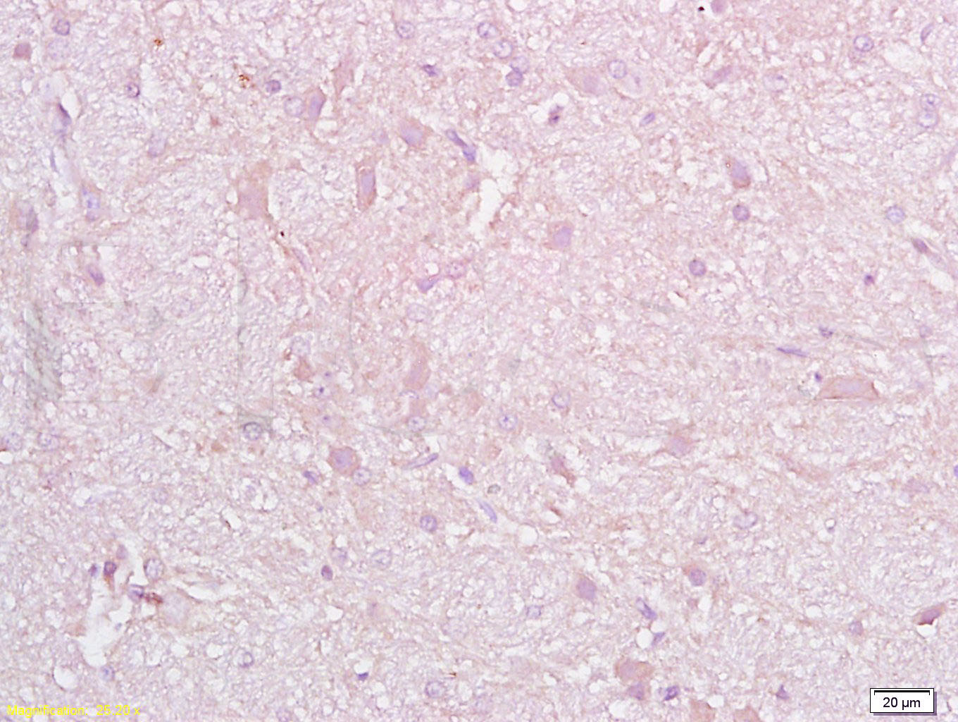 14 - CD38 Rabbit pAb AP94741