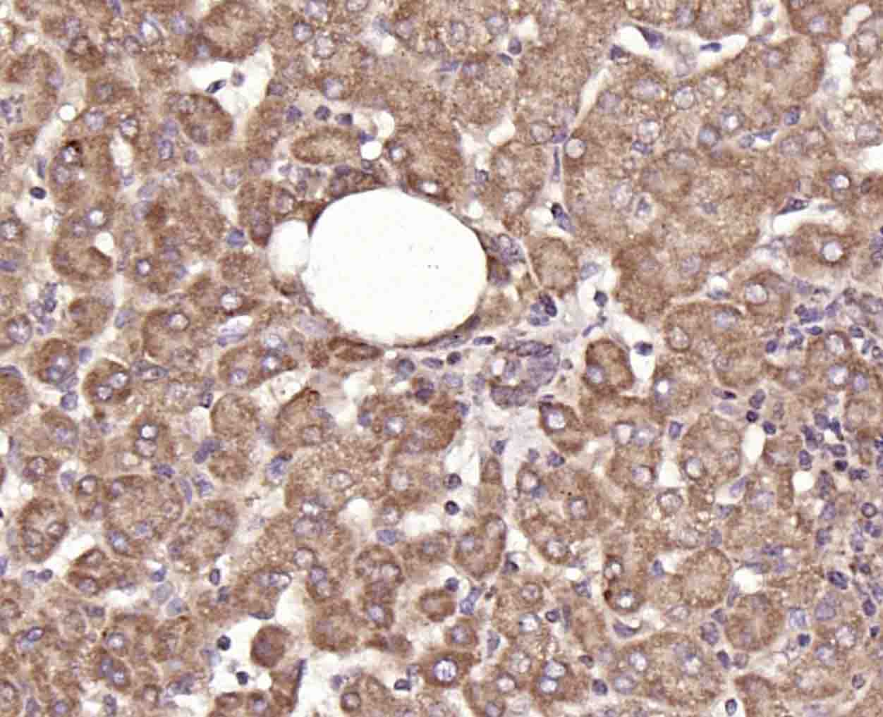 14 - Hrasls3 Rabbit pAb AP94744