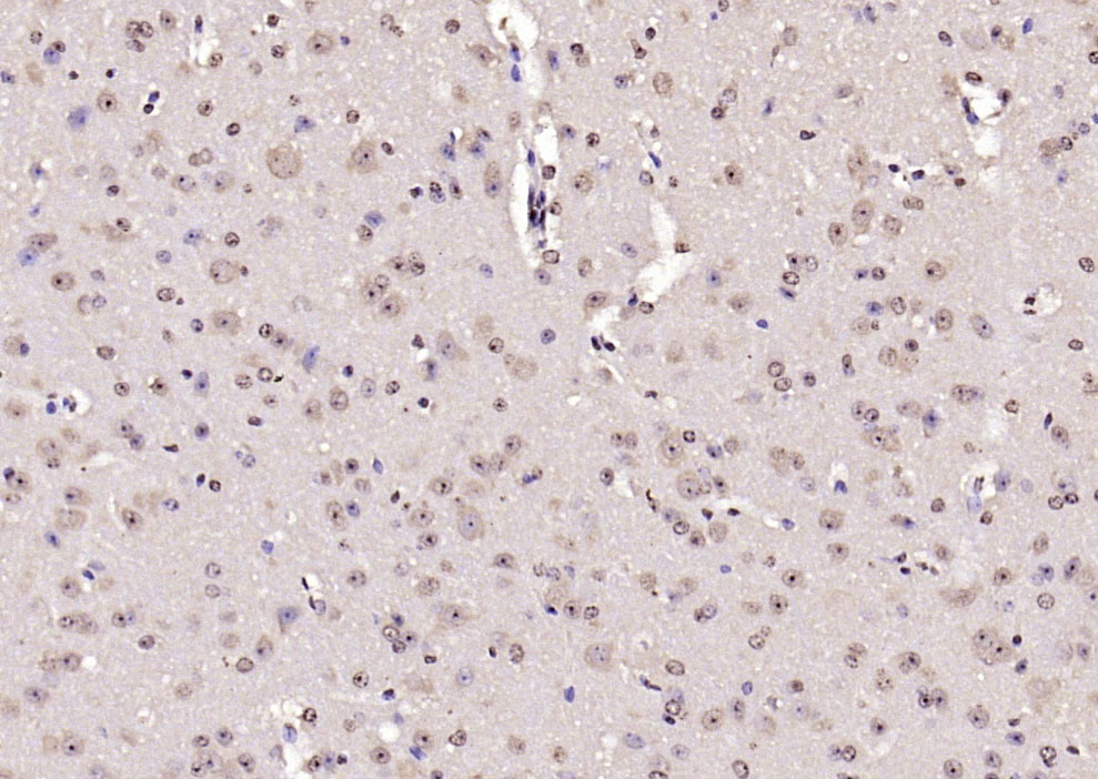 14 - UBE2Q1 Rabbit pAb AP94747