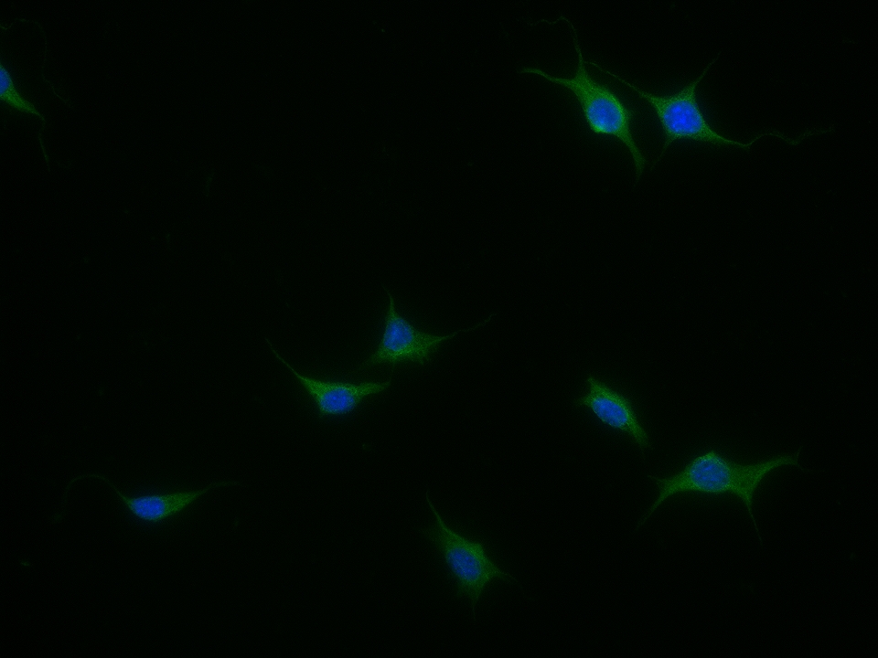 0 - PMP2 Rabbit pAb AP94751