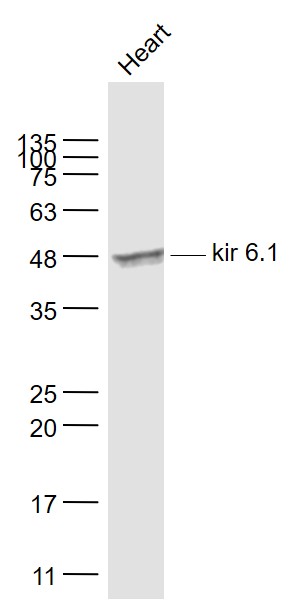 1 - kir 6.1 Rabbit pAb AP94753