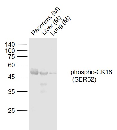 1 - phospho-CK18 (Ser52) Rabbit pAb AP94757