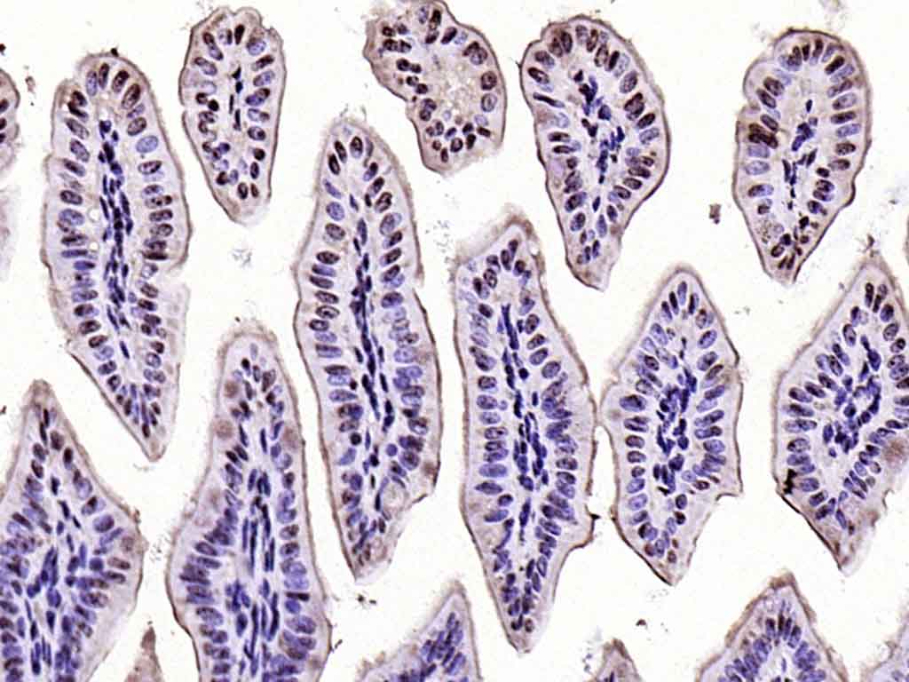 14 - phospho-CK18 (Ser52) Rabbit pAb AP94757