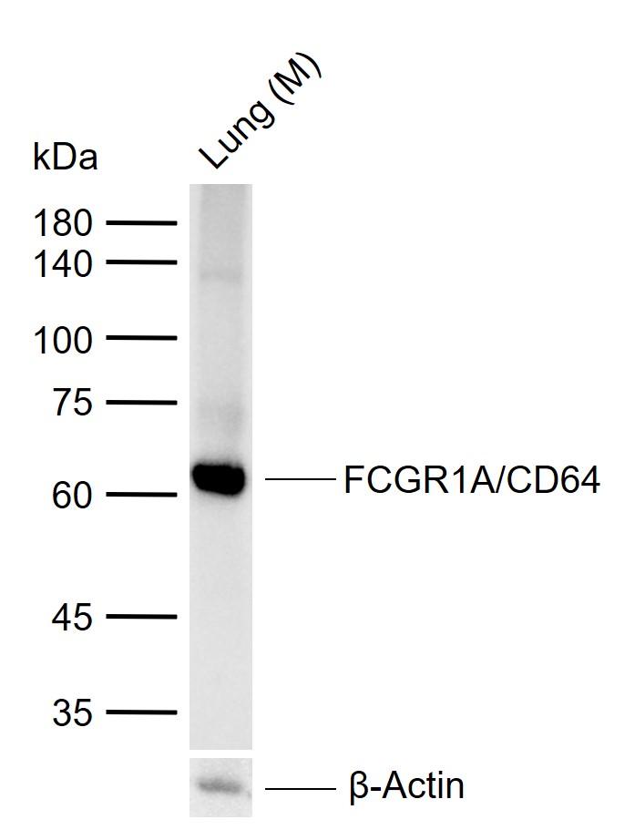 1 - FCGR1A/CD64 Rabbit pAb AP94758