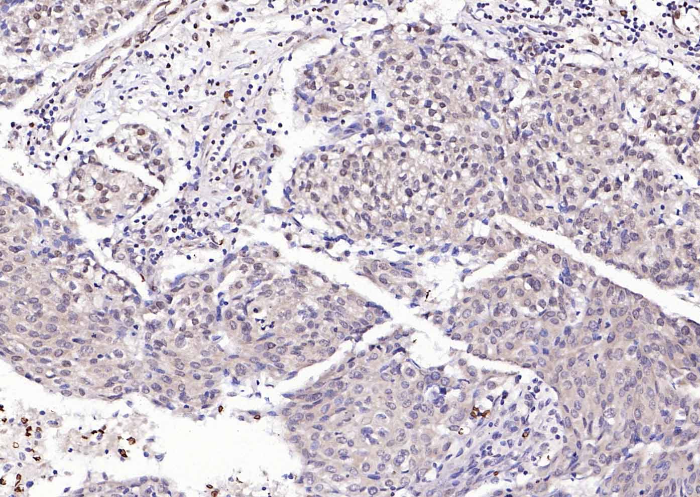 14 - USP34 Rabbit pAb AP94760