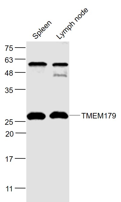 1 - TMEM179 Rabbit pAb AP94763