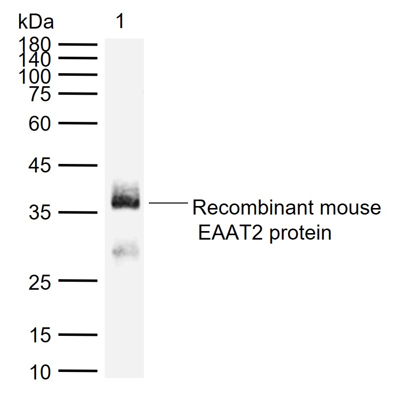 1 - EAAT2 Rabbit pAb AP94765