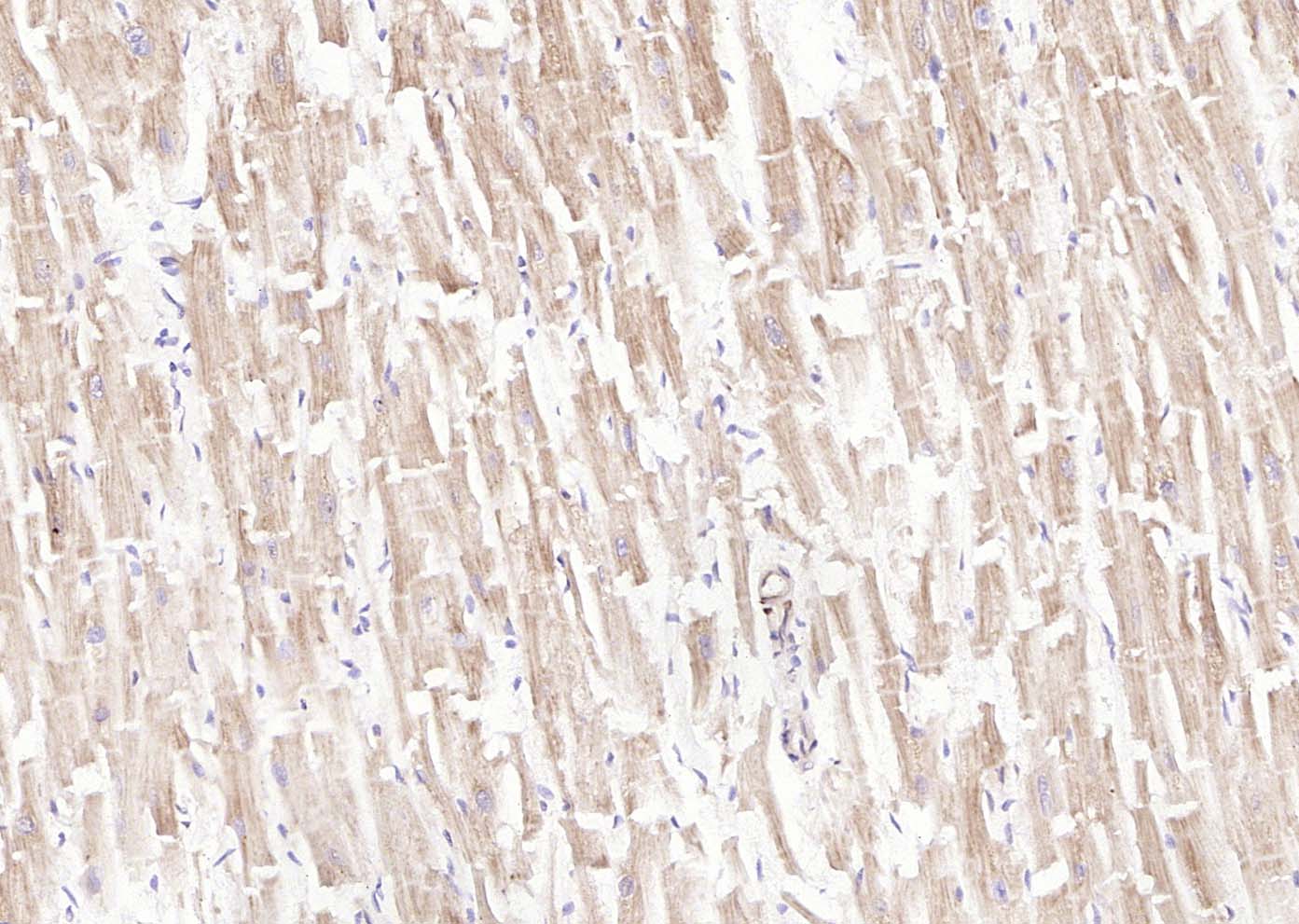 14 - LIFR Rabbit pAb AP94766