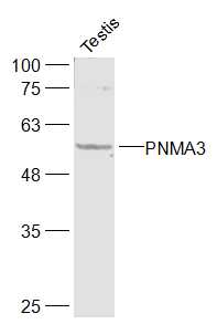 1 - PNMA3 Rabbit pAb AP94767