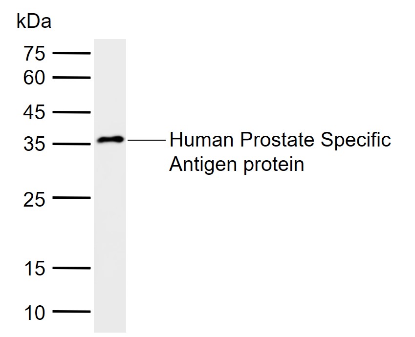 1 - Prostate Specific Antigen Mouse mAb AP94768