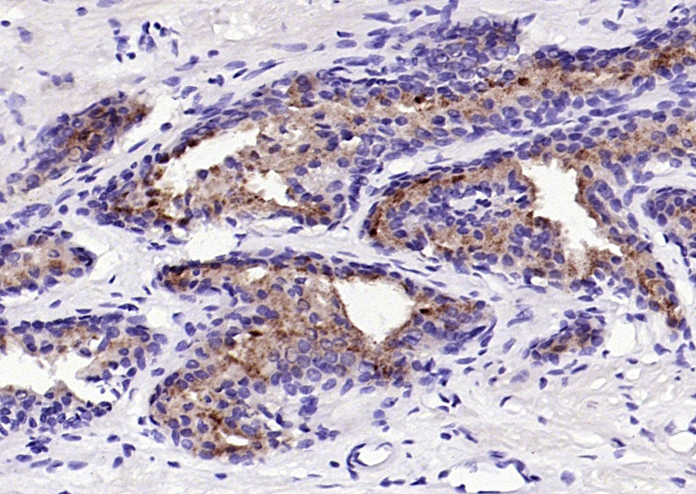 14 - Prostate Specific Antigen Mouse mAb AP94768