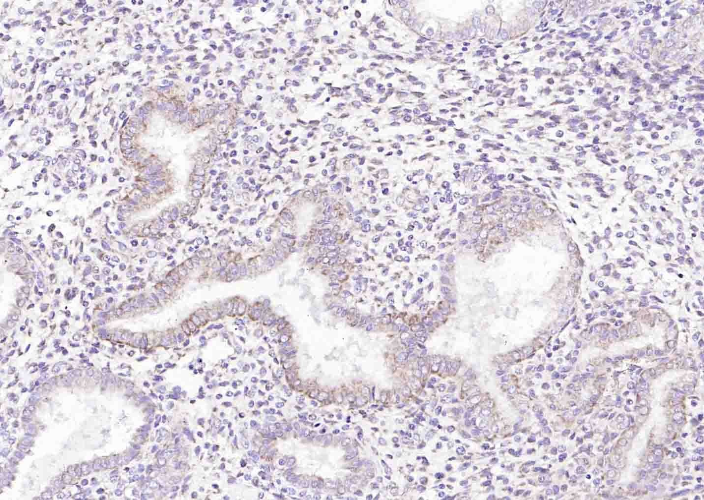 14 - Defensin alpha 5 Rabbit pAb AP94769
